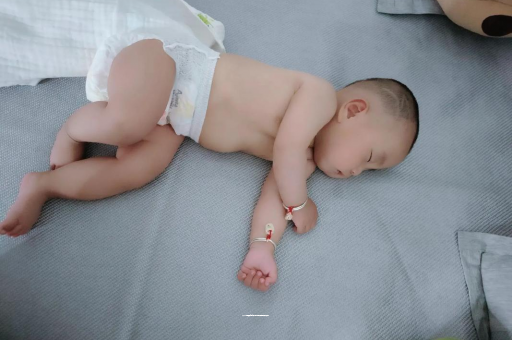 伊犁六个月宝宝眼睛散光